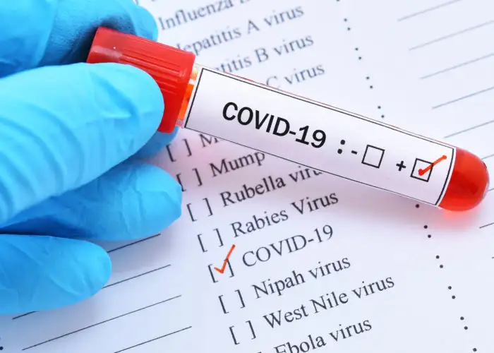 Positive COVID-19 test